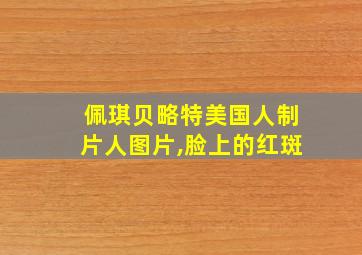 佩琪贝略特美国人制片人图片,脸上的红斑