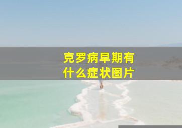 克罗病早期有什么症状图片