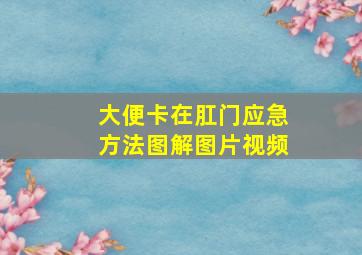 大便卡在肛门应急方法图解图片视频