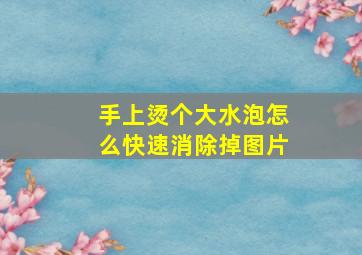 手上烫个大水泡怎么快速消除掉图片