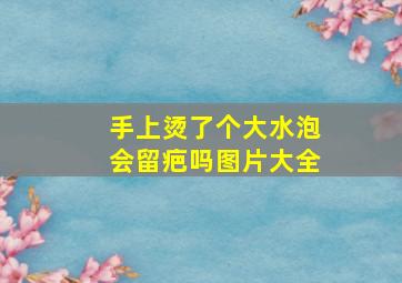 手上烫了个大水泡会留疤吗图片大全