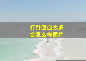 打针回血太多会怎么样图片