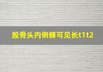 股骨头内侧髁可见长t1t2