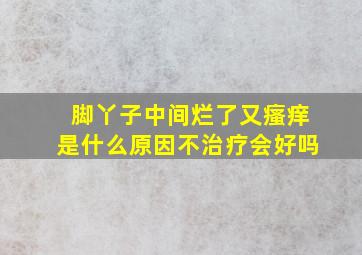 脚丫子中间烂了又瘙痒是什么原因不治疗会好吗