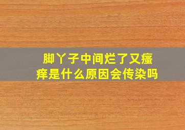 脚丫子中间烂了又瘙痒是什么原因会传染吗