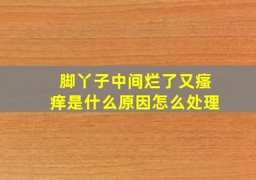 脚丫子中间烂了又瘙痒是什么原因怎么处理