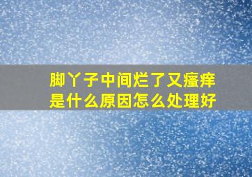 脚丫子中间烂了又瘙痒是什么原因怎么处理好