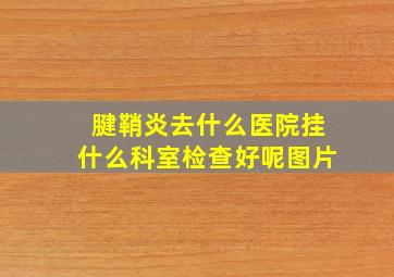 腱鞘炎去什么医院挂什么科室检查好呢图片