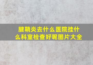 腱鞘炎去什么医院挂什么科室检查好呢图片大全