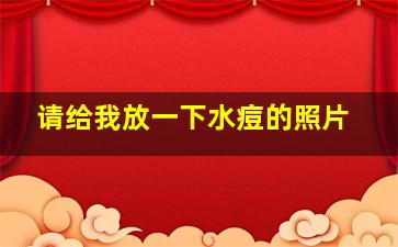 请给我放一下水痘的照片